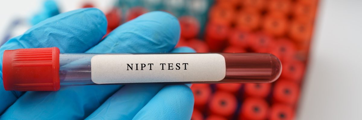 NIPT or Non Invasive Prenatal Testing, diagnosis for fetal Down syndrome test result with blood sample in test tube on doctor hand in medical lab